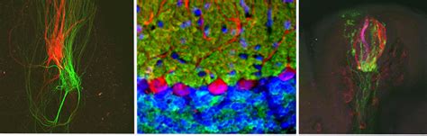 Neuroscience Major at Northwestern: A Pathway to Endless Possibilities