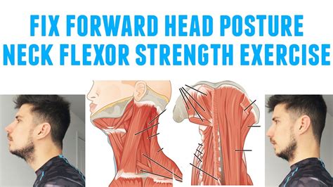 American Lean Posture: A Comprehensive Guide to Correcting Forward Head Syndrome