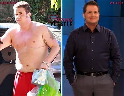 Chaz Bono Before & After: A Journey of Transformation Tips and Tricks for Supporting Transgender Individuals FAQs
