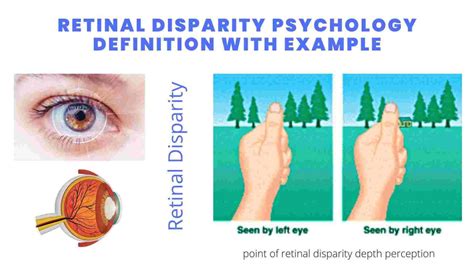 Retinal Disparity: The Key to Depth Perception Tables