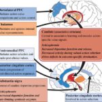 Schizophrenia Is Associated with an Excess of Receptors for