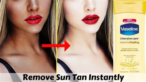 Are Tans Permanent?