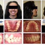 Granger Orthodontics: Revolutionizing Smiles in West Valley