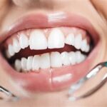 Hansen Orthodontics Brooklyn: Achieving Radiant Smiles and Optimal Oral Health