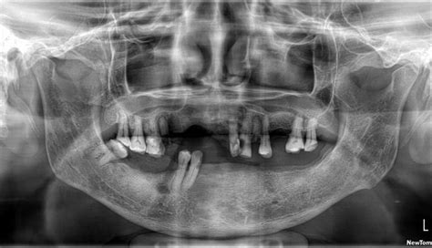 Oral and Maxillofacial Radiology Residency Programs: A Comprehensive Guide Helpful Tables